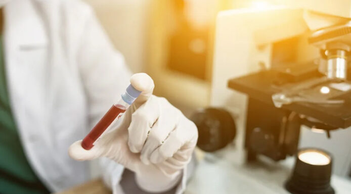 Lab tech holding a blood vial in a lab.